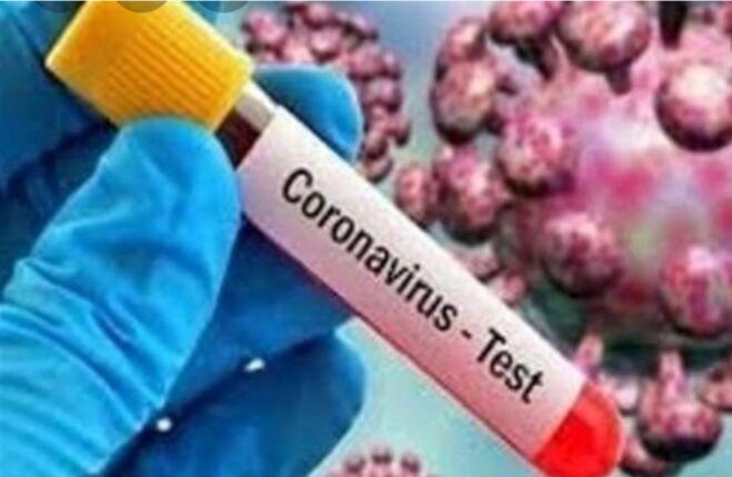 خبرنگاران تأیید نخستین مورد ابتلا به کرونا در سومالی خبرنگاران تأیید نخستین مورد ابتلا به کرونا در سومالی